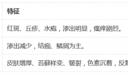 提高警惕！肛周湿疹可不是普通湿疹~
