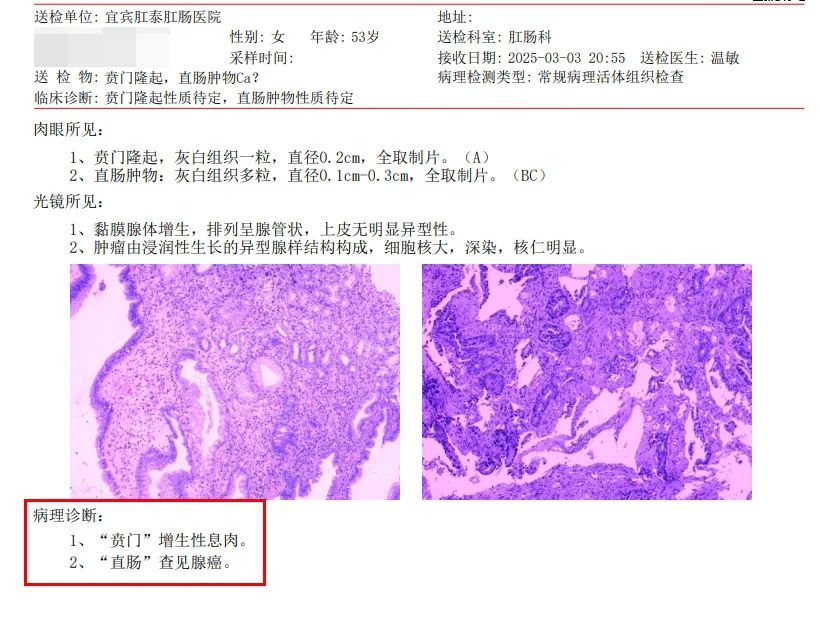 53岁大姐的体检经历，给所有人敲响警钟：这个检查，40岁后千万别省！