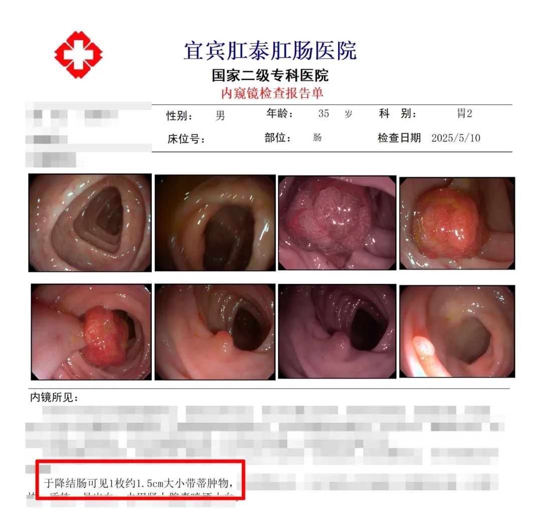 便血背后暗藏危机！35岁男子肠镜竟查出癌前病变——这些人群应及时做肠镜筛查